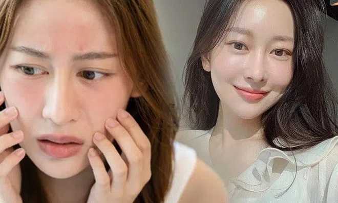 Mùa nắng ngồi máy lạnh, da lão hóa thần tốc, nàng công sở phải làm gì để tái sinh da dẻ?