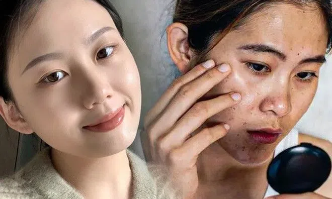 Không phải tại tuổi tác, có 10 thói quen khiến chị em chưa qua 40 mà da dẻ đầy nếp nhăn, thua xa bạn bè