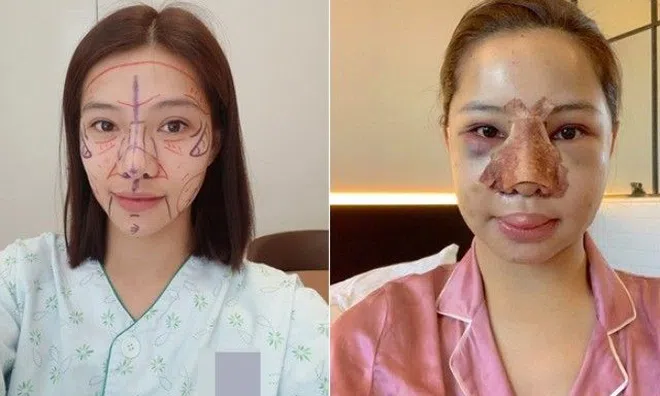 Không phải vì phong thủy, đây là 6 phương pháp "dao kéo" chị em nên tránh làm kẻo tiền mất tật mang