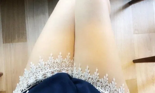 Người phụ nữ bị sa tử cung nghiêm trọng suốt 30 năm