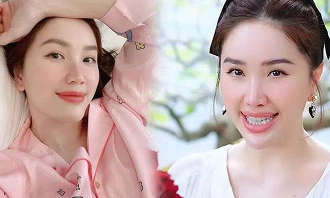 Bảo Thy khoe làn da phát sáng nhưng lộ vết bầm tím, nghi vấn thẩm mỹ trỗi dậy sau bao năm?