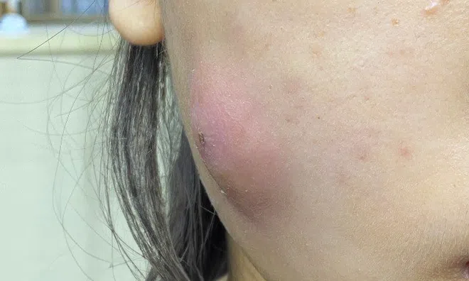 Cô gái má hóp quyết đi làm đẹp vì ai cũng chê để rồi phải chịu cái kết cay đắng vì một “cú lừa”