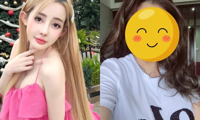 Ngân 98 công khai phẫu thuật thẩm mỹ 10 lần, vẫn chưa là gì so với "vợ Trấn Thành"