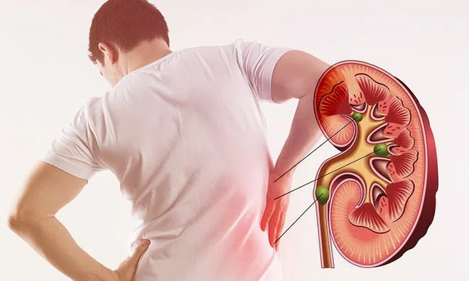 5 dấu hiệu cho thấy thận của bạn đang khỏe mạnh