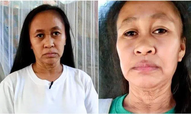 Thiếu nữ 16 tuổi bỗng biến thành bà lão chỉ trong vòng 2 năm