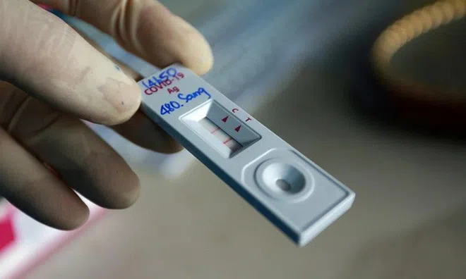 Khẩn: Test nhanh dương tính SARS-CoV-2 tại nhà, người dân không tự ý vào viện