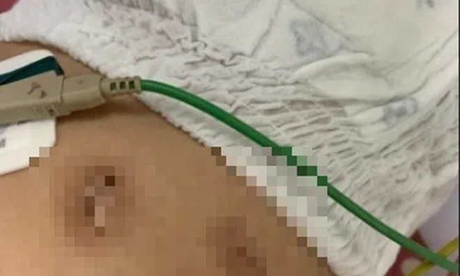 Sức khỏe bé gái 18 tháng tuổi bị đôi vợ chồng hành hạ ở Hà Nội hiện ra sao?