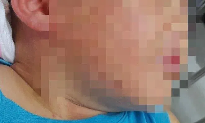 Vụ cháu bé 3 tuổi bị nhốt trong tủ cấp đông: “Tủ lạnh dưới 0 độ C, cháu bị đè bởi 5 kg đá lạnh”