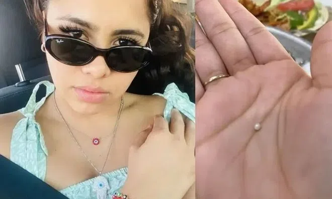 Bạn trai rủ ăn nhà hàng, cô gái bất ngờ cắn được viên ngọc quý