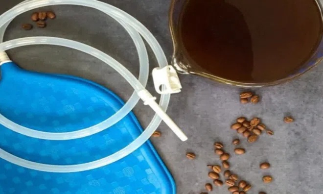 Tin tức đời sống ngày 5/7: Người phụ nữ vỡ trực tràng do thải độc bằng cách thụt tháo cà phê