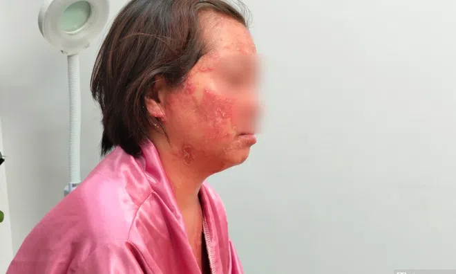 Nỗi đau của người phụ nữ mắc căn bệnh nhiều người không dám đến gần