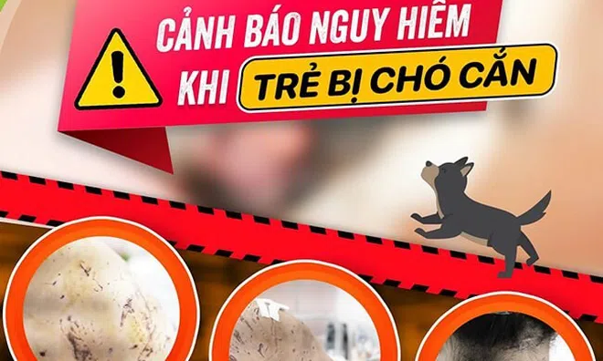 Theo bố tới chỗ làm việc, bé gái 7 tuổi bị 4 con chó cắn hàng trăm vết