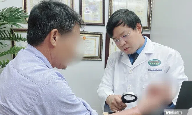 Hối hận vì đắp nhựa cây xương rồng như "thần dược" chữa viêm da cơ địa