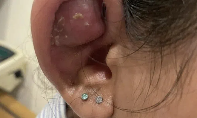 Làm đẹp theo cách này, thiếu nữ tai biến thành "Trư Bát Giới"
