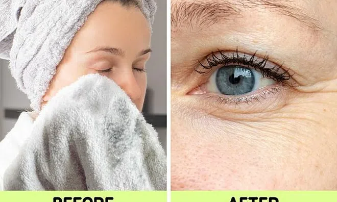 Dùng khăn lau khô mặt vô tình khiến da dễ bị mụn và nhiều nếp nhăn