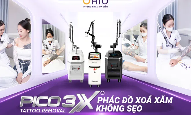 Giá xóa hình xăm tại Phòng khám da liễu OHIO? Các yếu tố ảnh hưởng đến giá