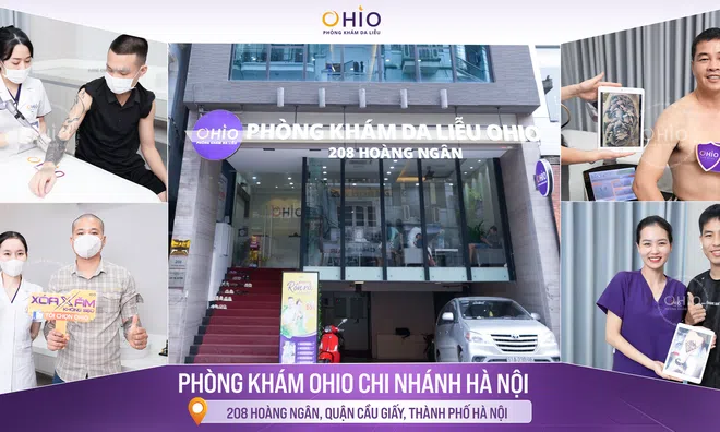 Top 1 địa chỉ Xóa xăm uy tín tại Hà Nội