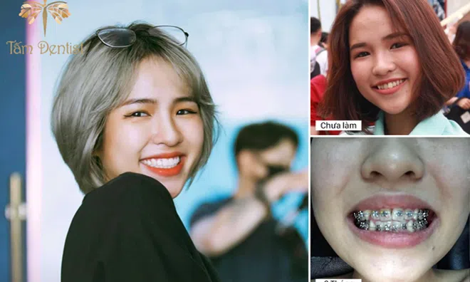 Khách hàng tin tưởng lựa chọn tấm Dentist vì lý do gì?