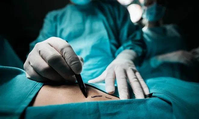 Đau lòng tin nhắn cuối cùng của bà mẹ 3 con qua đời vì phẫu thuật giảm cân