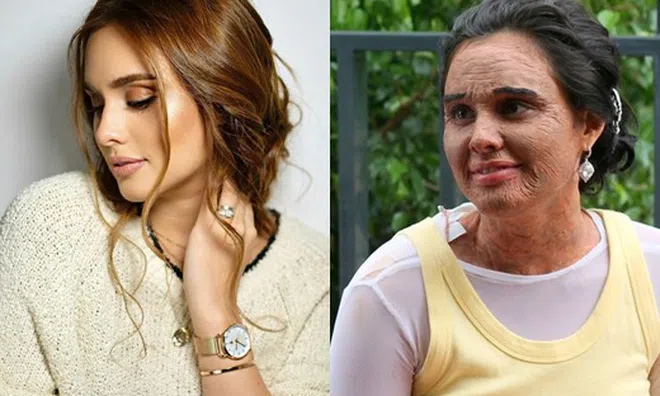 Mỹ nhân Philippines Max Collins "hi sinh" nhan sắc cho vai diễn lớn nhất trong suốt 7 năm hoạt động nghệ thuật