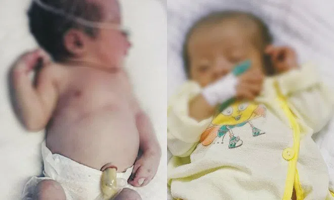 Từ vụ bé sơ sinh vừa chào đời đã mắc giang mai, bà bầu hết sức lưu ý