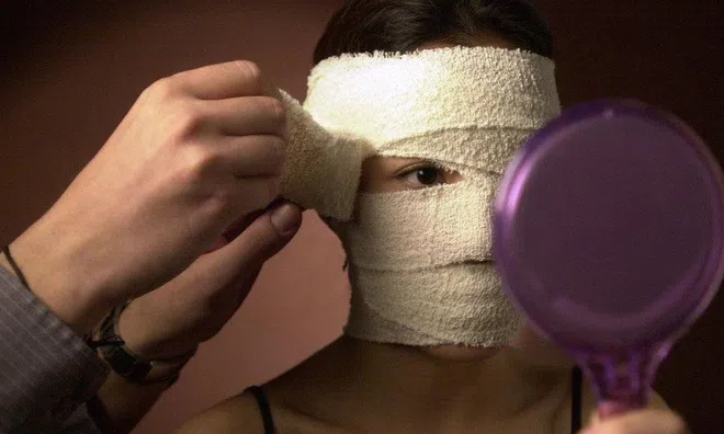 Phụ nữ gồng mình, chịu đau đớn để làm đẹp