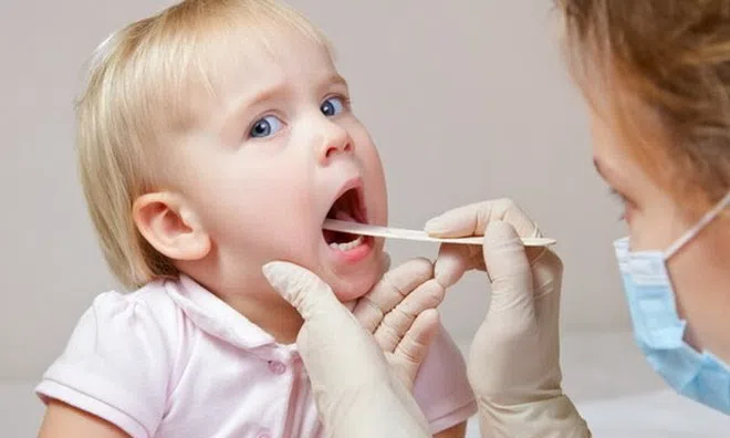 Bác sĩ Lê Phương chia sẻ cách chữa viêm amidan cho trẻ em bằng thảo dược