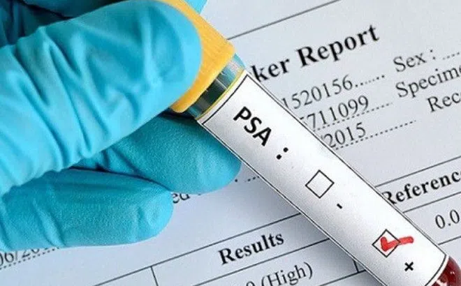 Xét nghiệm máu thấy chỉ số về ung thư bình thường chớ vội mừng: Bác sĩ lý giải "bí mật" ai cũng cần biết