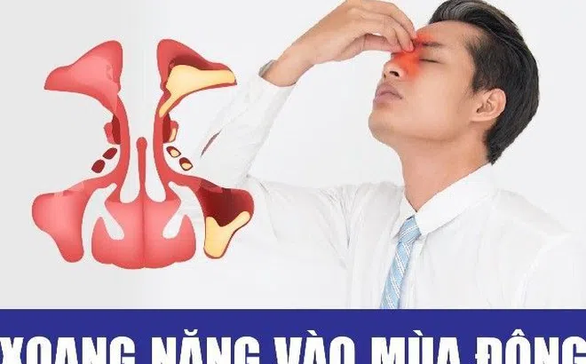 Chuyên gia cảnh báo viêm xoang tái phát mùa đông và cách khắc phục hiệu quả nhất