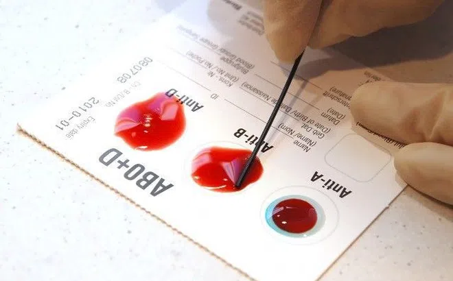 Những người có nhóm máu này thường ít bệnh tật nhưng có thể khó có con, dù là nam hay nữ