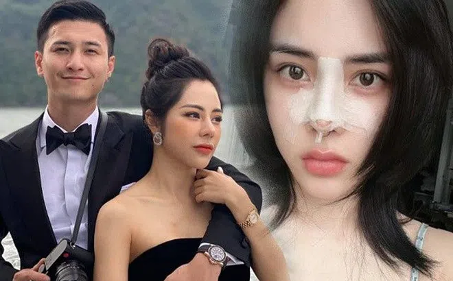 Tốn trăm triệu sửa đi sửa lại chiếc mũi, bạn gái Huỳnh Anh vẫn chưa ưng ý, than "thấp lè tè lại to đùng"