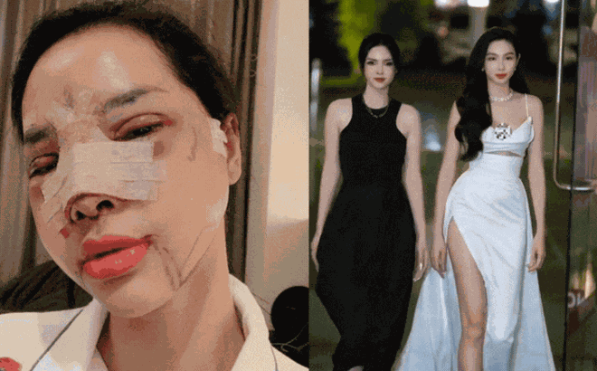 Mẹ bỉm 2 con thẩm mỹ đổi đời, đứng cạnh Hoa hậu Thùy Tiên vẫn đẹp rạng ngời, khó bị lấn át