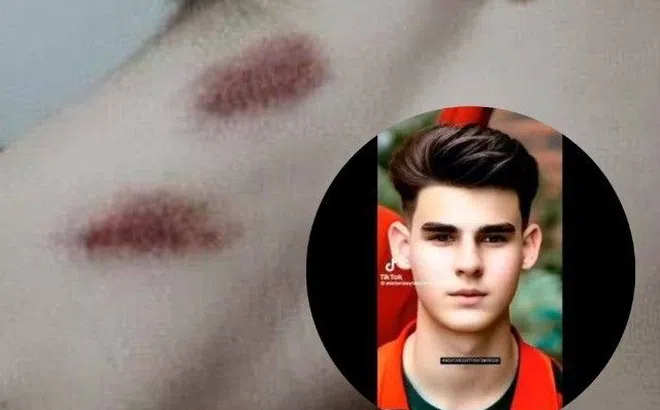 Nam thanh niên được bạn gái hơn 7 tuổi hôn mạnh vào cổ, chẳng ngờ vài tiếng sau ngã lăn ra đất tử vong