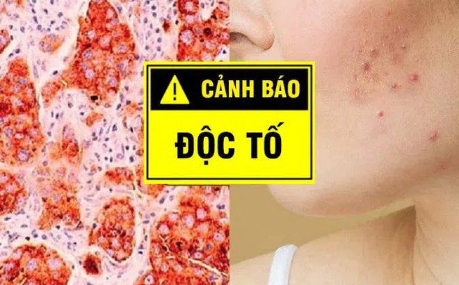 10 dấu hiệu cảnh báo cơ thể ngập độc tố, có điều nhìn bằng mắt thường là nhận ra ngay