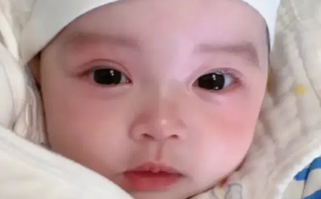 Bé sơ sinh vừa chào đời đã đẹp như thiên thần dù bố mẹ ngoại hình bình thường, bác sĩ phải thốt lên: Thật hiếm có!