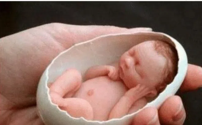 Bé sơ sinh nhỏ nhất thế giới, cân nặng 280 gram, có thể nằm gọn trong vỏ trứng gà