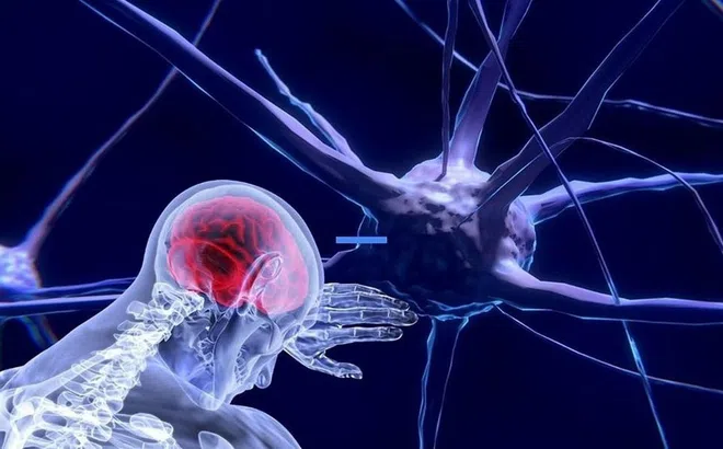 Tác động của Covid-19 tới não người không như chúng ta từng nghĩ