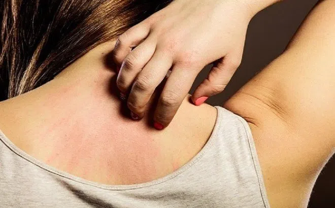 Đi khám vì ngứa ngáy, người phụ nữ bất ngờ với chẩn đoán của bác sĩ