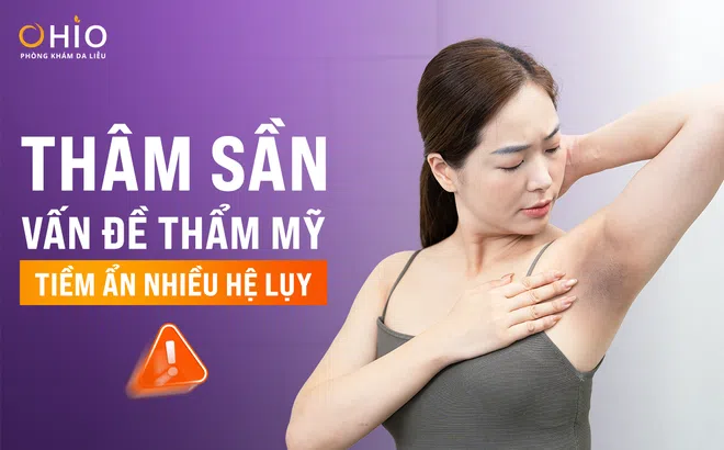 Thâm sần – vấn đề thẩm mỹ tiềm ẩn nhiều hệ lụy