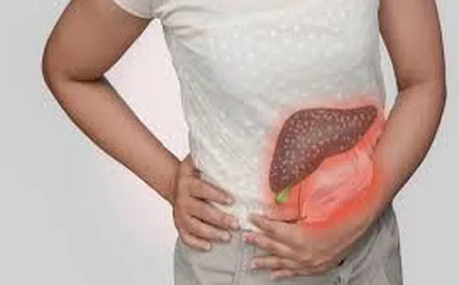 Đau bụng sau khi ăn buffet, cô gái 30 tuổi tử vong chỉ sau 48 giờ, bác sĩ cảnh báo bệnh diễn tiến cực nhanh