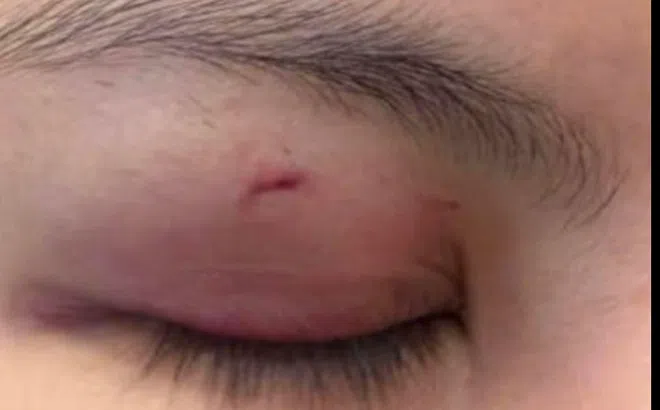 Trung Quân Idol xin lỗi công khai sau ồn ào bị tố hành hung nữ bác sĩ