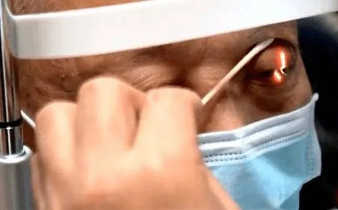 Người đàn ông cứ ăn là rơi nước mắt, nguyên nhân do mắc chứng bệnh bất ngờ