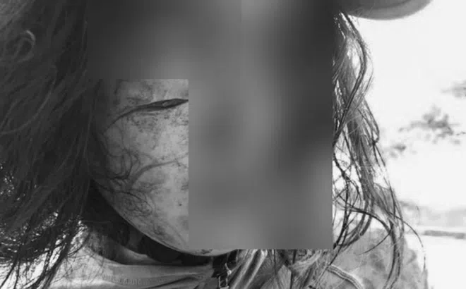 Đi làm giấy tờ ly hôn, người phụ nữ bất ngờ bị tấn công, rạch mặt