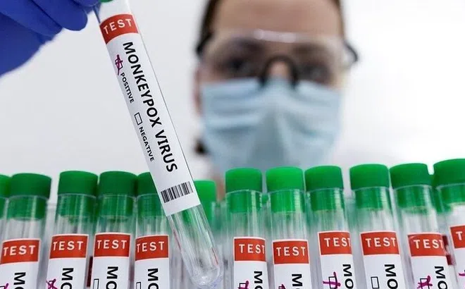 Nóng: Bộ Y tế yêu cầu đo thân nhiệt tại cửa khẩu, giám sát ca mắc đậu mùa khỉ