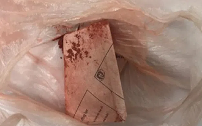 Tin tức đời sống ngày 19/4: Rơ lưỡi bằng thuốc cam, bé 1 tuổi nhiễm chì trong máu nặng