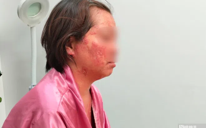 Nỗi đau của người phụ nữ mắc căn bệnh nhiều người không dám đến gần