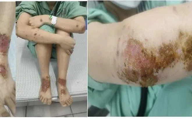 Tin tức Đời sống 24/11: Bùng phát bệnh hô hấp bí ẩn ở Trung Quốc