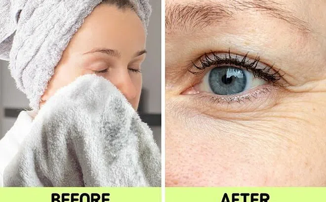 Dùng khăn lau khô mặt vô tình khiến da dễ bị mụn và nhiều nếp nhăn