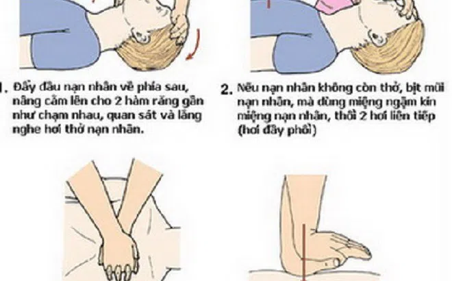 Cách sơ cứu người bị tai nạn giao thông