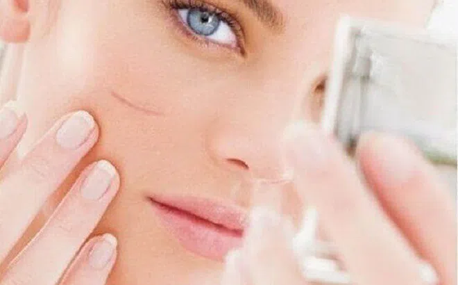 Tác hại khi dùng kem trị sẹo giả, kém chất lượng